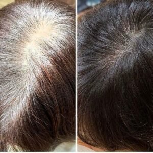 صبغة جذور الشعر Hair Dye Rooting